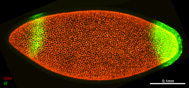 Bild aufgenommen von:  Andres Hertel  Max-Planck-Institut f�r biophysikalische Chemie  FG Molekulare Zelldynamik  Am Fa�berg 11  D-37077 G�ttingen