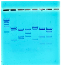 DNA-Fingerprinting: DNA-Material eines Verbrechens. Ganz links (Spur 1) ist ein DNA-Längenstandard auf dem Agarosegel aufgetragen. Dann folgen die Probe, welche am Tatort gefunden wurde, auf den Spuren 3 ? 7 jeweils DNA-Proben der Verdächtigen. Spur 2 und 5 stimmen in ihrem Bandenmuster überein, stammen also von der gleichen Person. Ist diese Person der Täter? Das Agarosegel wird von