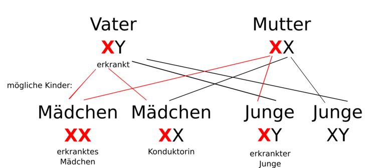 Hämophilie: Der Vater ist erkrankt, die Mutter ist Trägerin. Nun zeigt sich die X-Chromosomal vererbte Krankheit deutlich in der nächsten Generation! Mit welcher Wahrscheinlichkeit können Jungen und Mädchen betroffen sein.