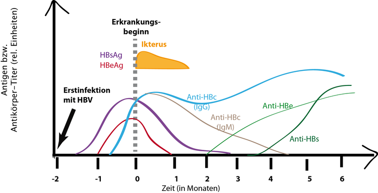 Verlauf einer Hepatitis-B-Infektion. Gezeigt ist der Verlauf der Antigen- bzw. Antikörperkonzentrationen im Blut eines Patienten nach Infektion mit Hepatitis-B-Viren. Der Anti-HBc-Antikörper bleibt langfristig erhalten.