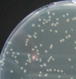 LB-Wachstumsmedium mit Antibiotikum Ampicillin. Nur Zellen mit Resistenz können wachsen.