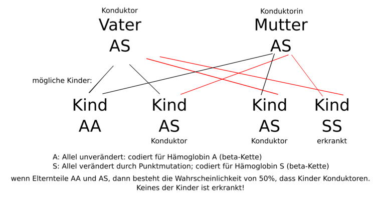 Vererbungsschema Sichelzellanmämie: die Erbkrankheit wird autosomal-rezessiv vererbt.